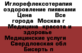 Иглорефлексотерапия, оздоровление пиявками › Цена ­ 3 000 - Все города, Москва г. Медицина, красота и здоровье » Медицинские услуги   . Свердловская обл.,Бисерть п.